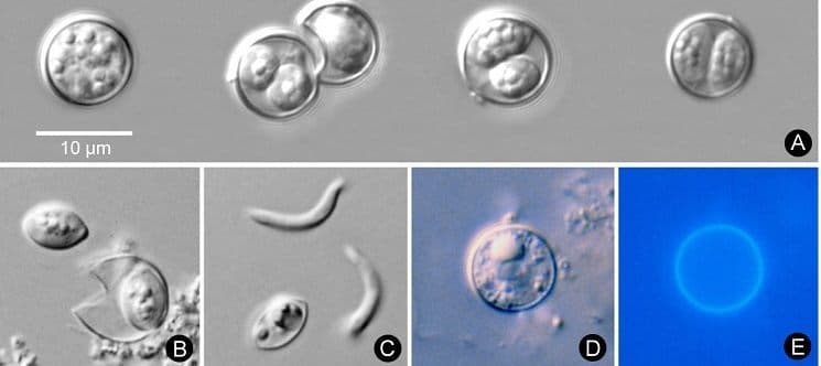 Cyclospora Outbreak 2026: What's Behind the "Explosive Diarrhea" Surge